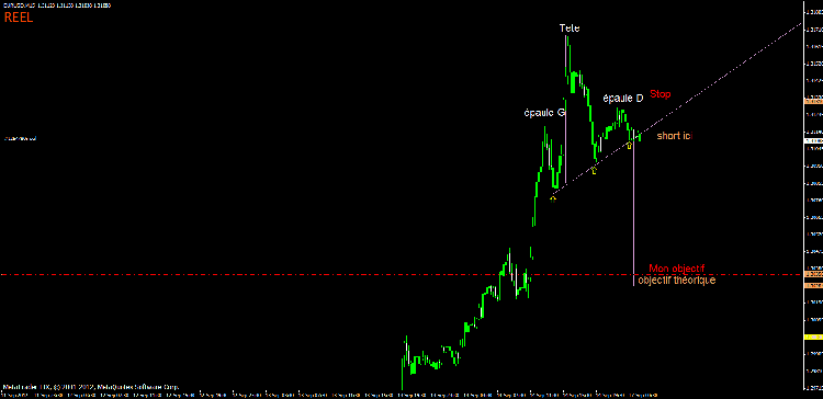 tete epaule eur 15min.gif